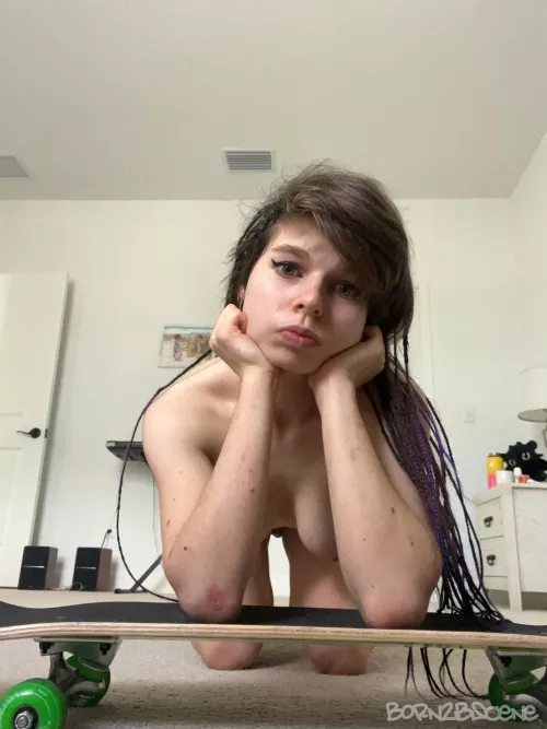 skinned elbow skate pic 😝