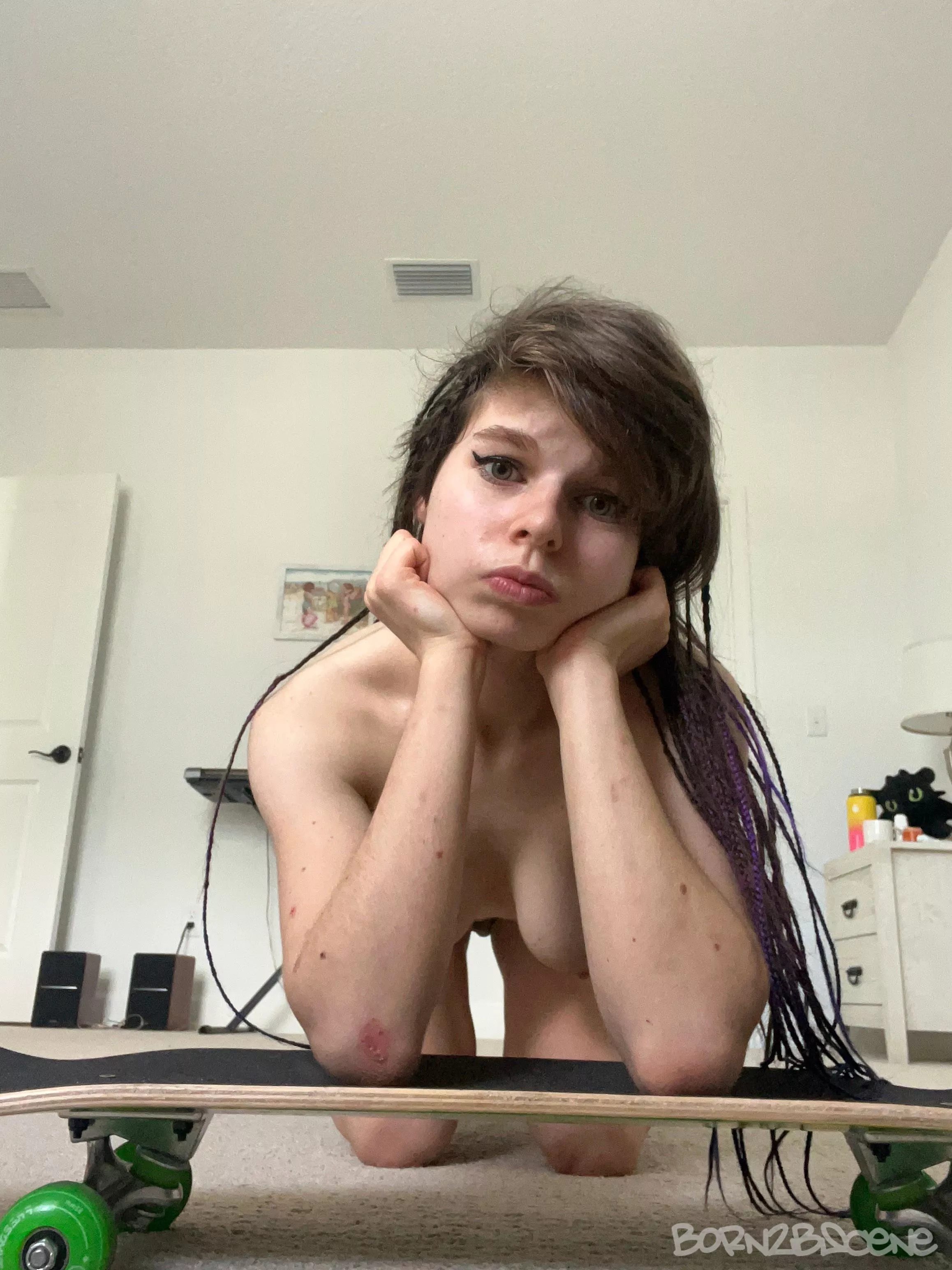 skinned elbow skate pic 😝