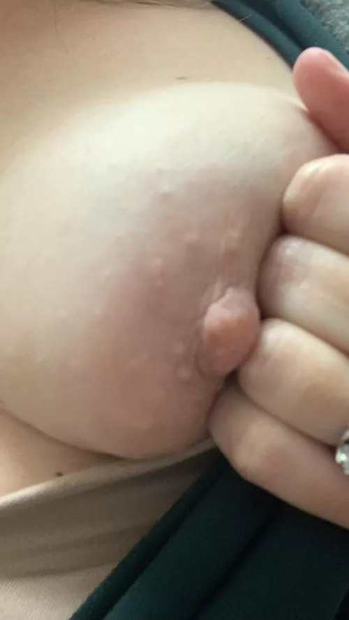 It's like all of my breast