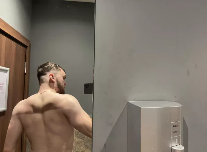 Just a reminder having stretch marks is normal! :)