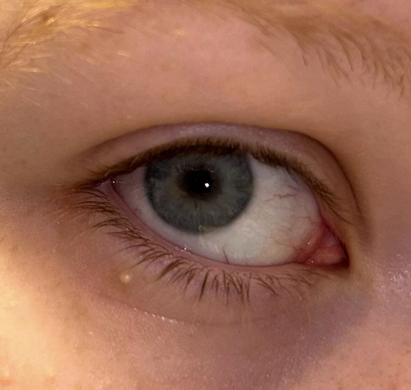 This dude has been under my eye for months now.