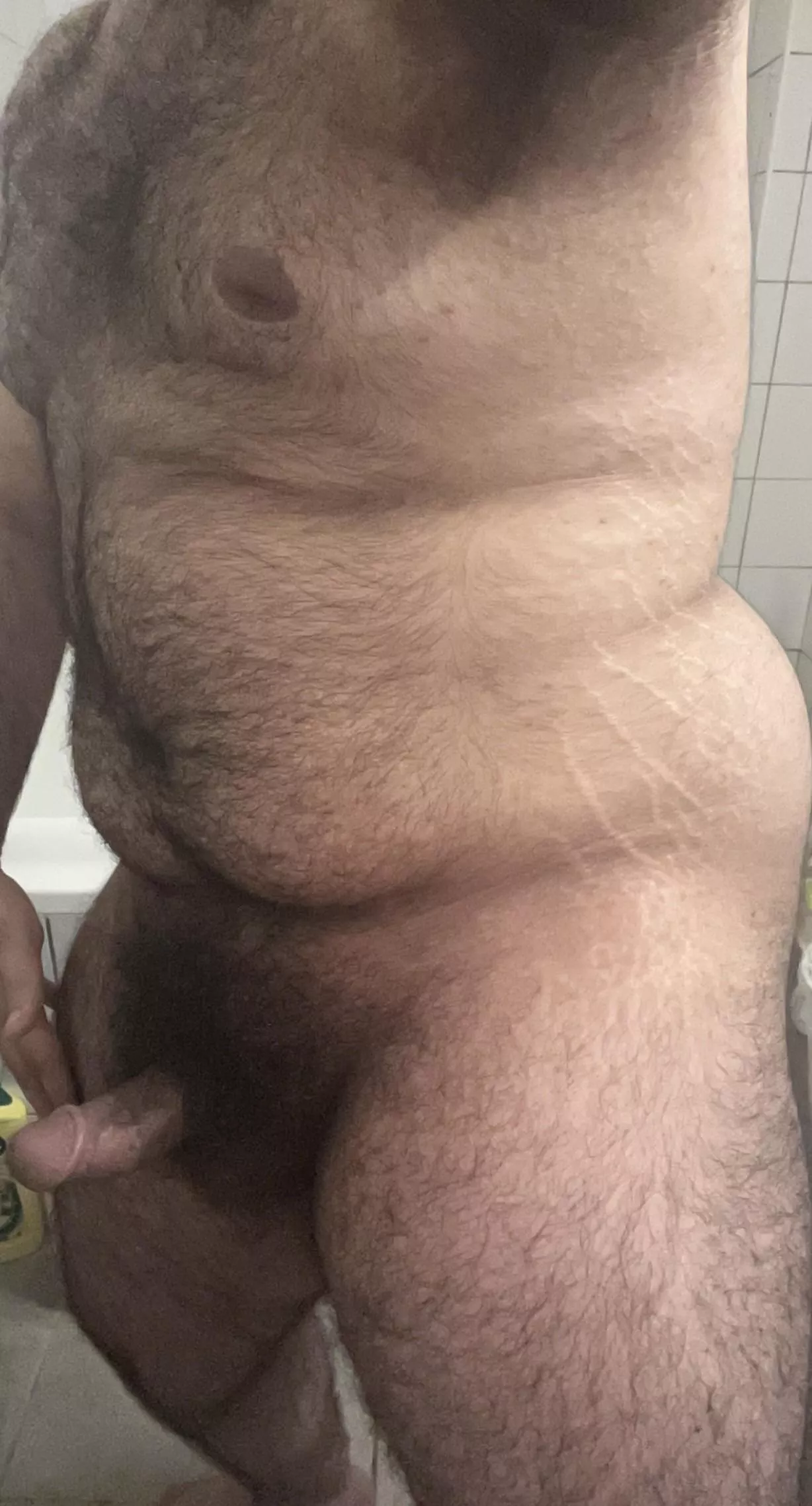 (20) since you all liked my stretch marks last time, here is more of it.