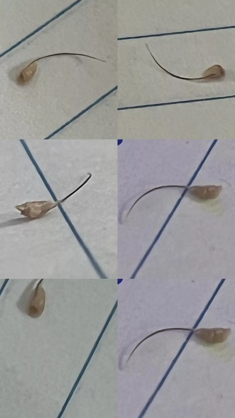 Hairy Houdini the Magic Hair Folicle