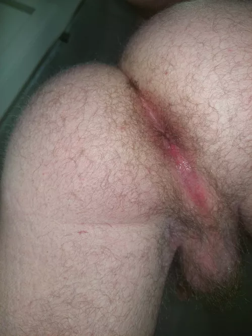 Do you like furry man asses?