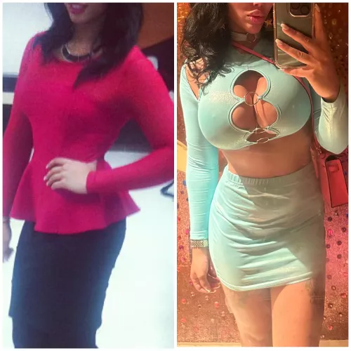 (OC) 10 year difference and 5 hours before flipping over my left implant 😭😭