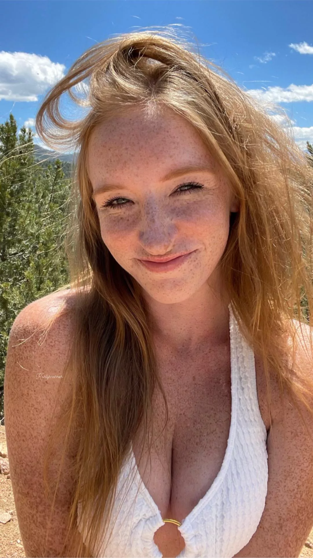 If my freckles could say one thing..what would it be