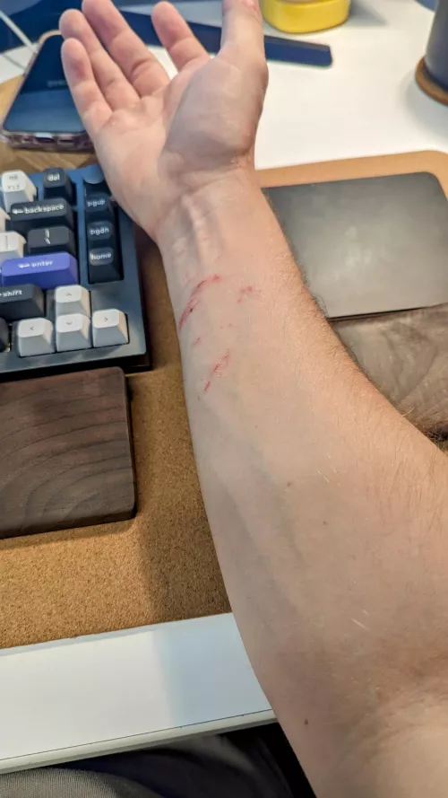 showin' off my booboo in the nsfw forearm sub 💪