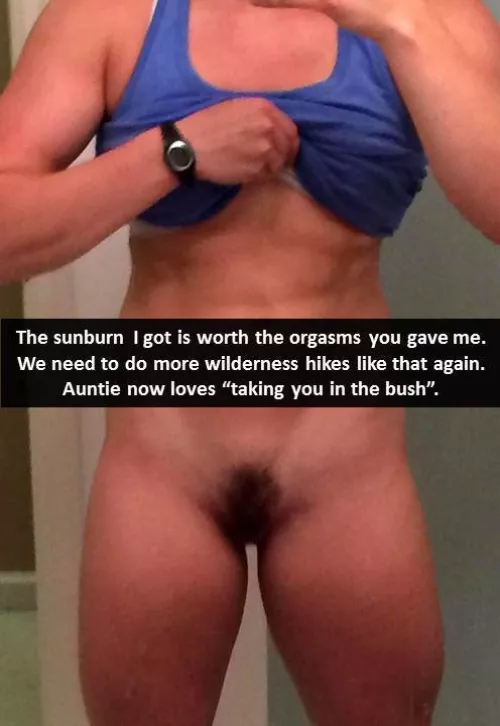 Sunburn on the Snapchat