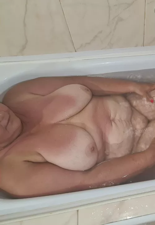 Boob Treatment for young hearts.