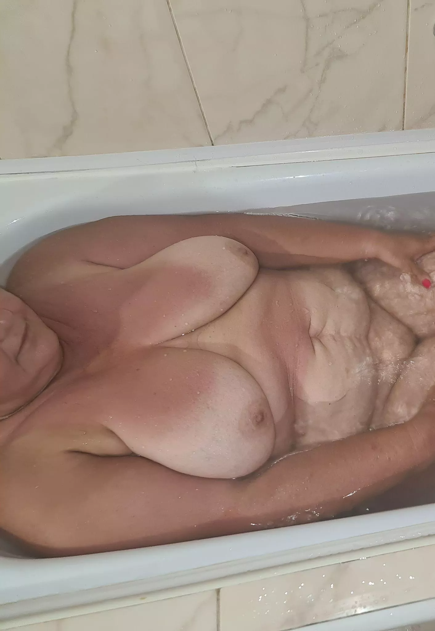 Boob Treatment for young hearts.