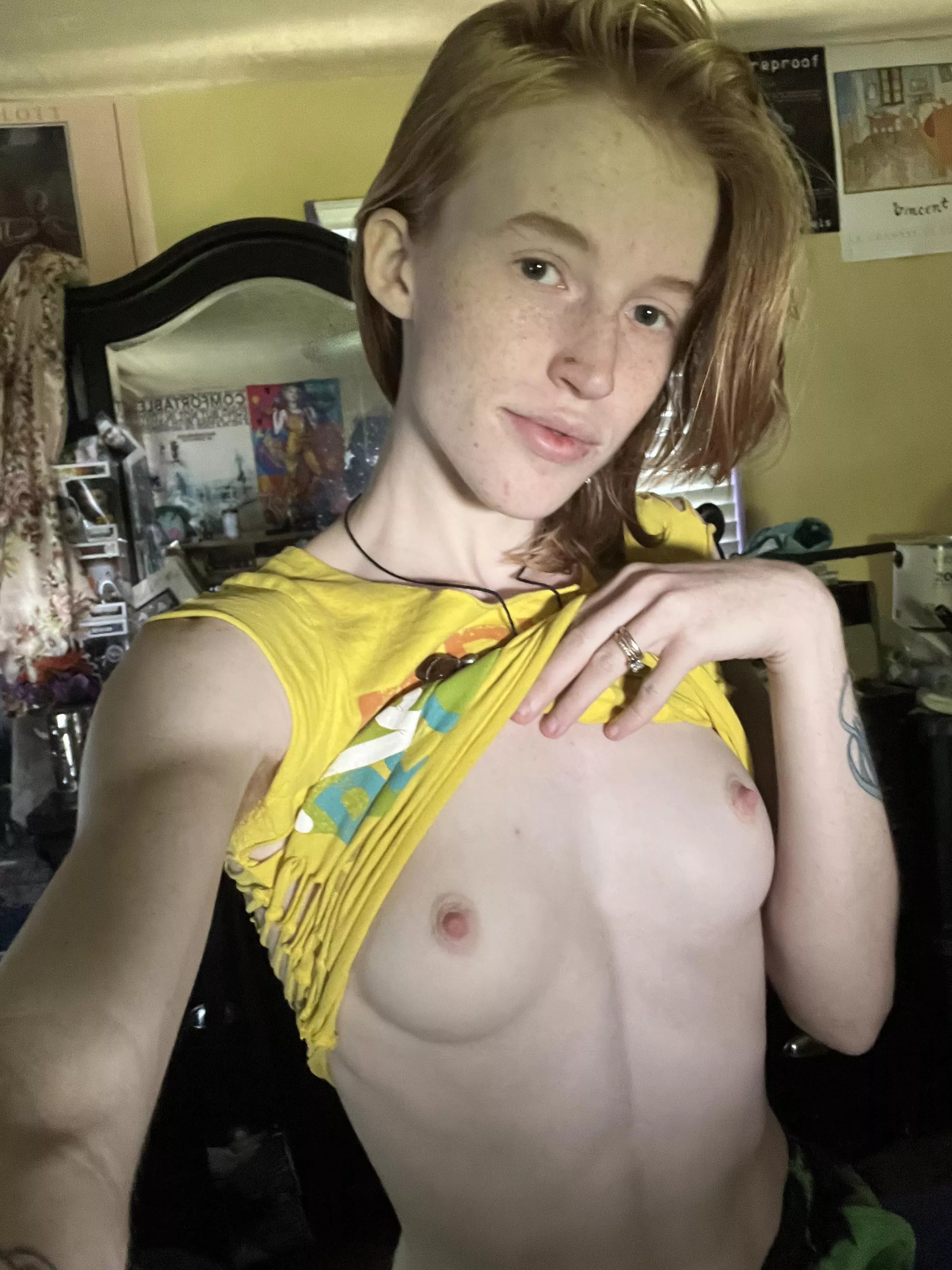 even have freckles on my lips!