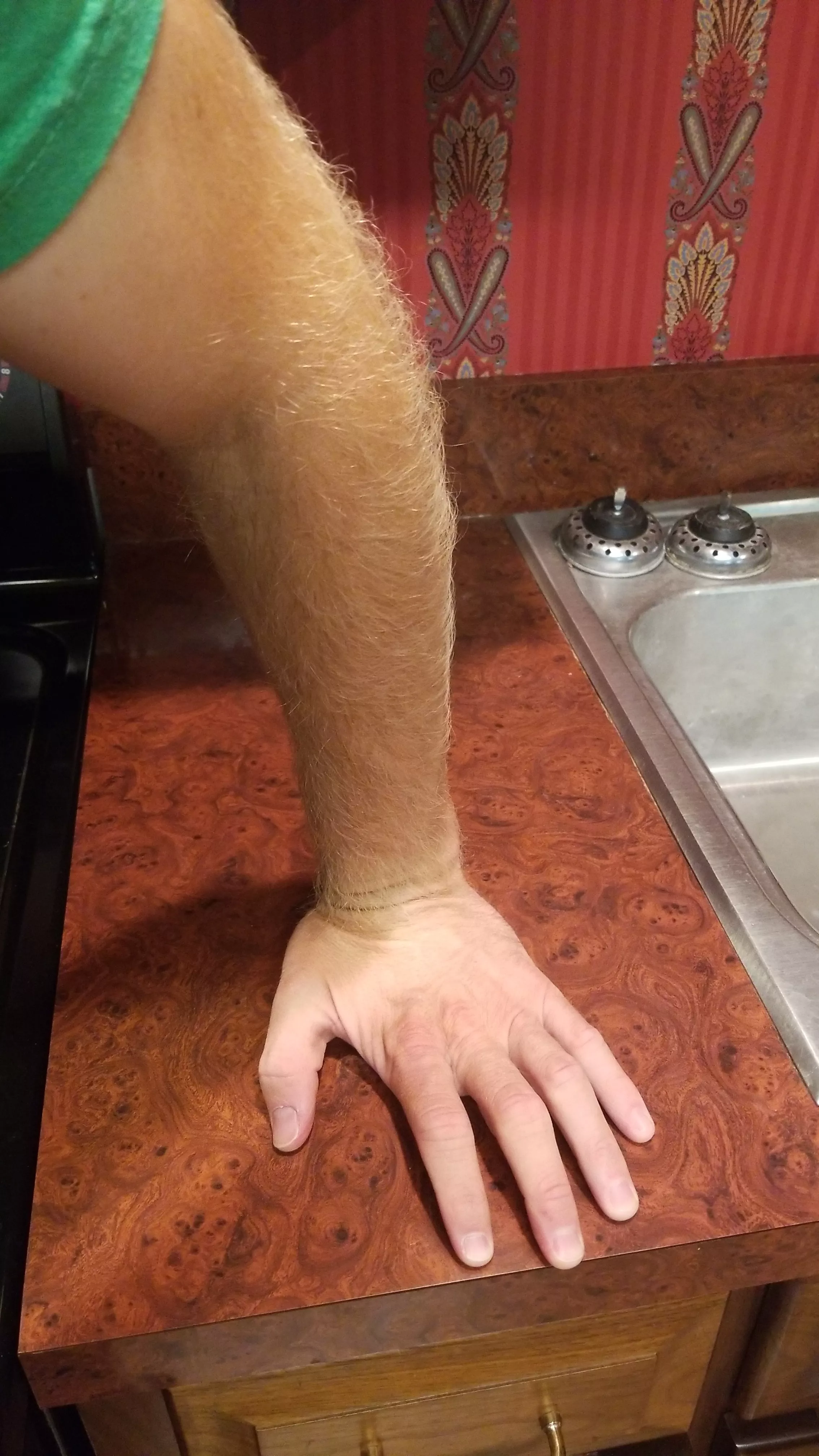 Furry ginger forearm