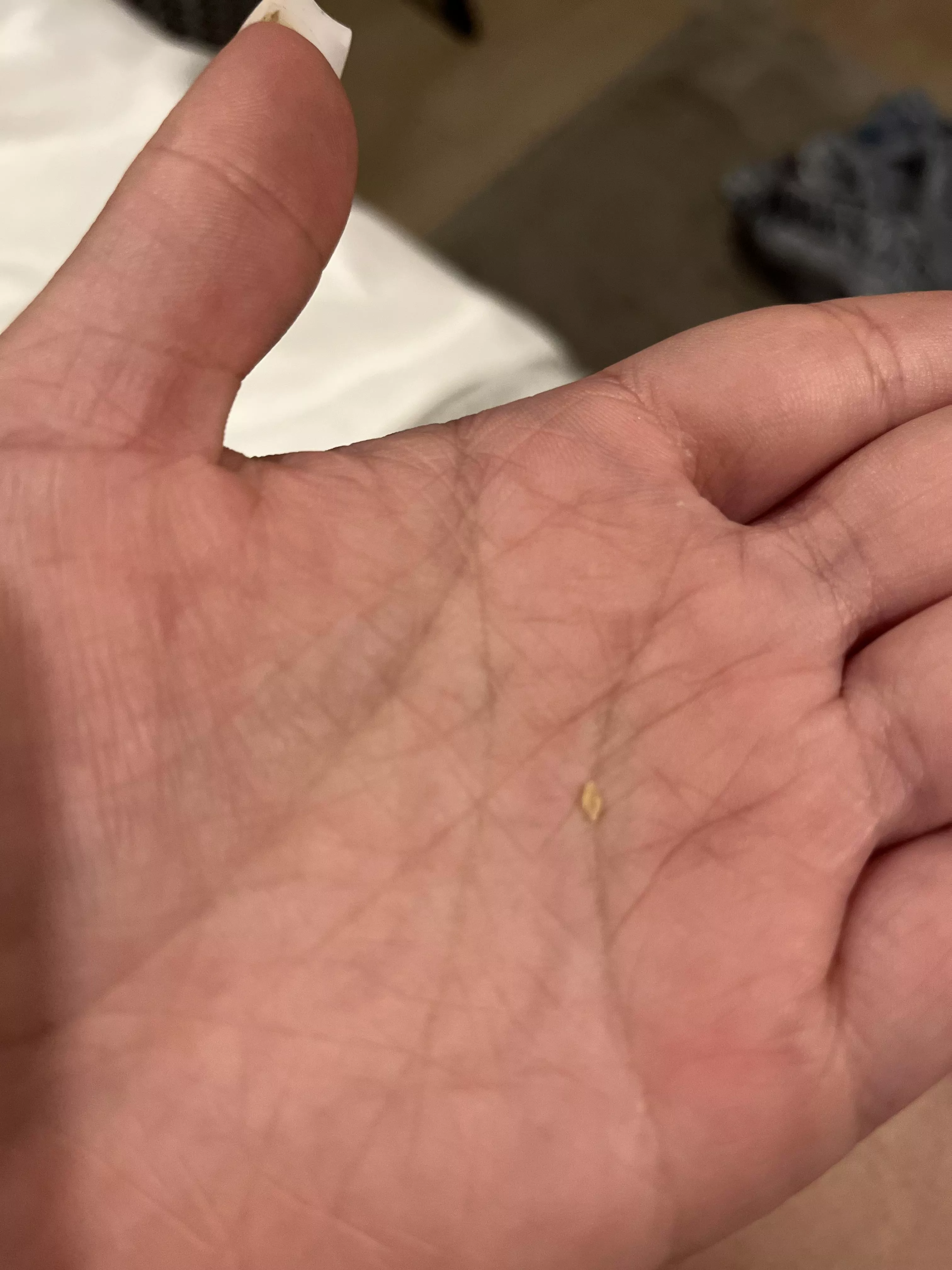 had the urge of scratching my scalp. This came out