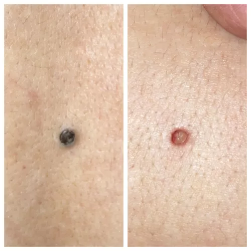 Stupid Pore of Winer—!