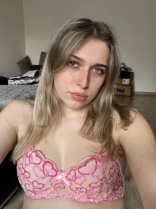 I think i collected too many freckles