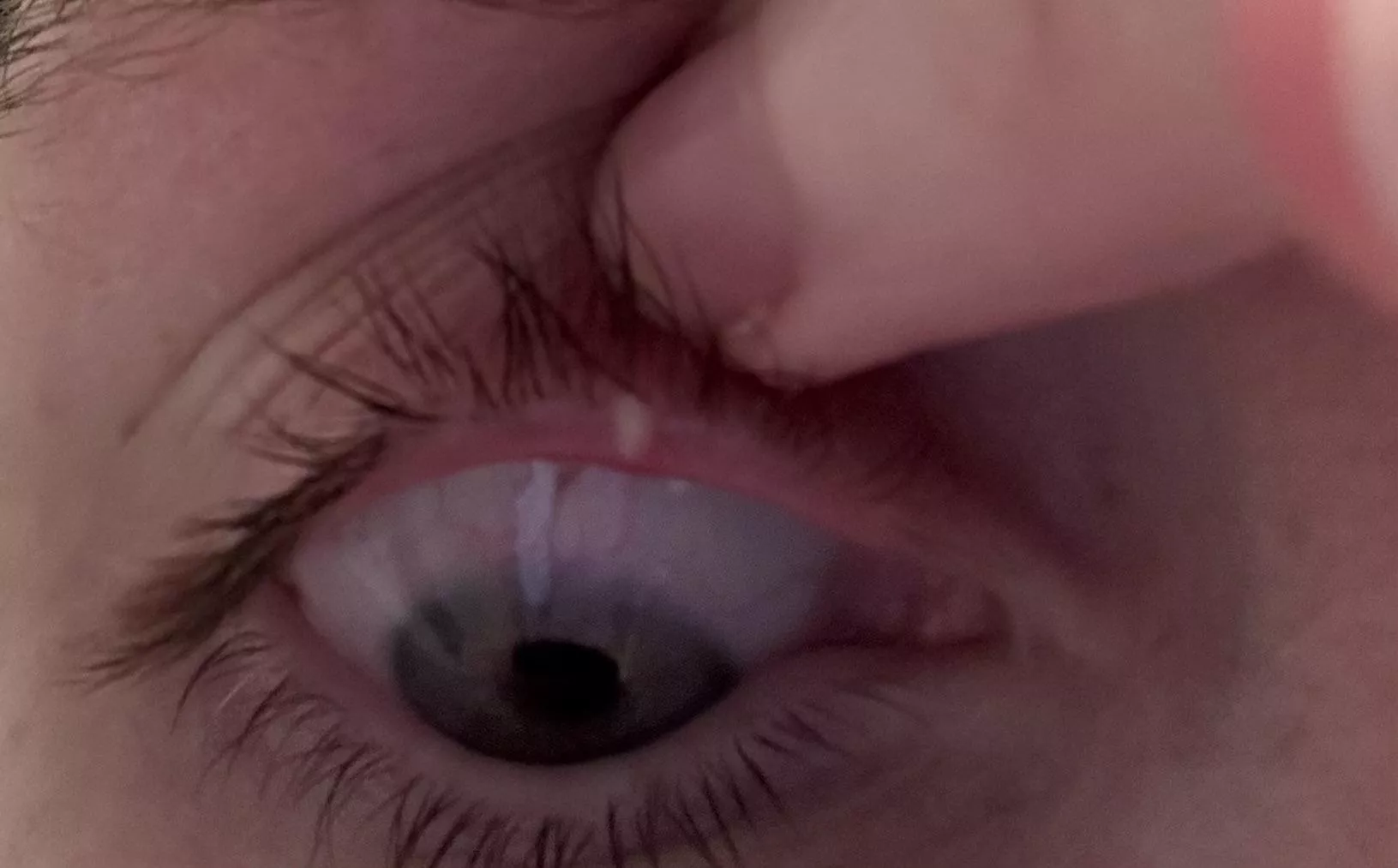 Stye. Started last night. Was able to get it so drain with a warm compress this morning.