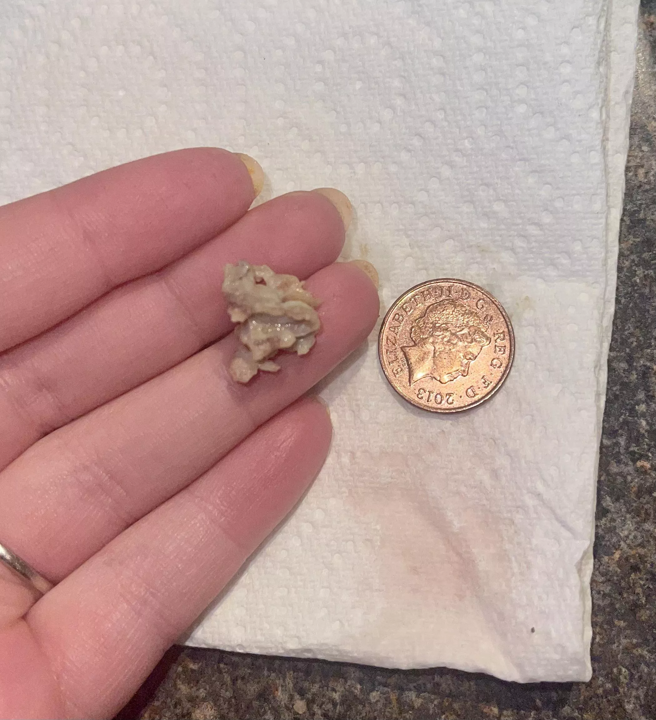 [update] on the thing I birthed from my mouth