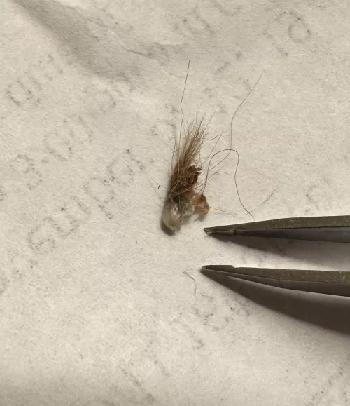 Went mining in husband’s belly button.