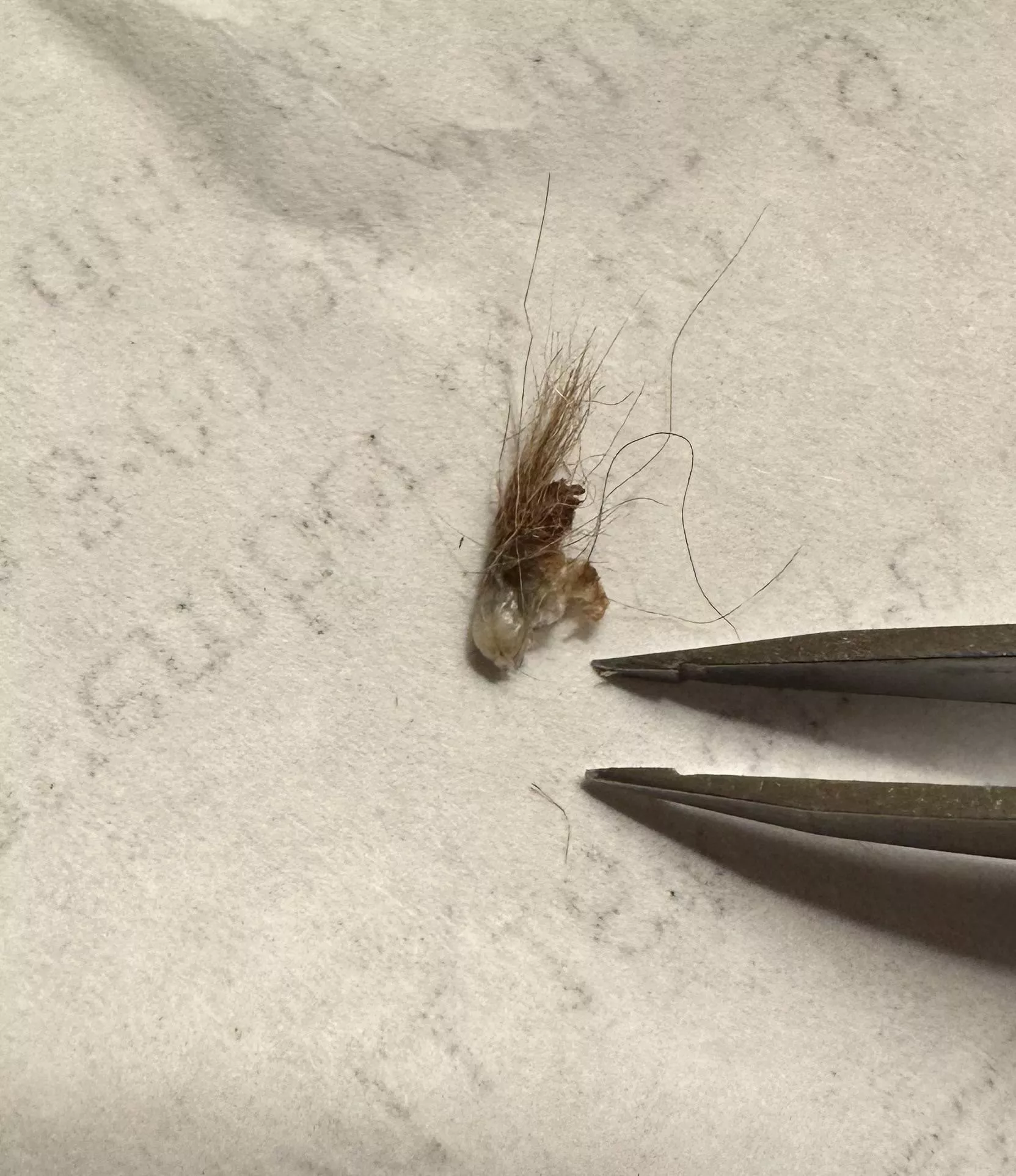 Went mining in husband’s belly button.