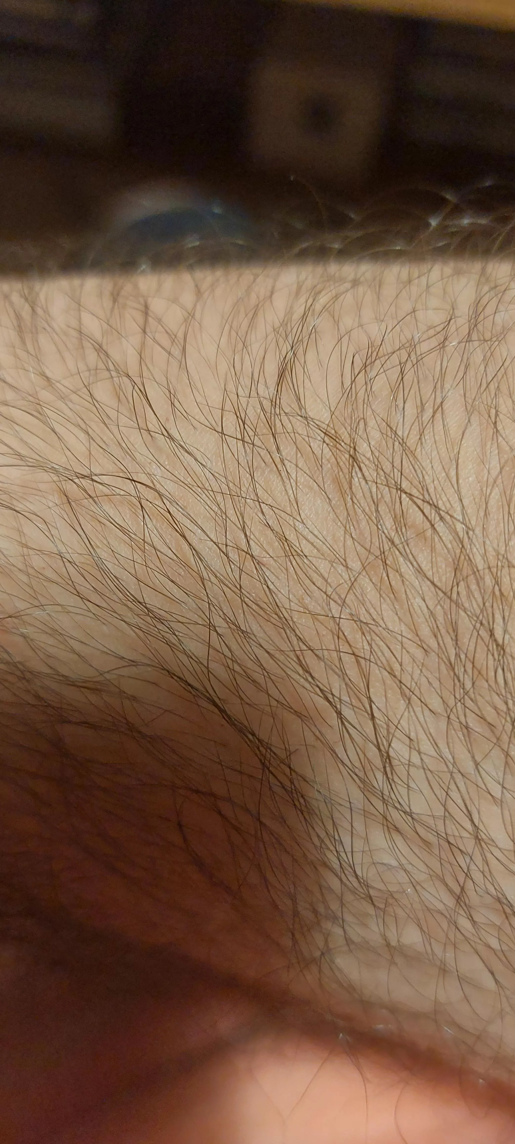 Transition Advice for Body Hair