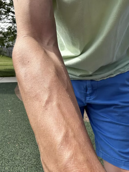 Accidental forearm selfie