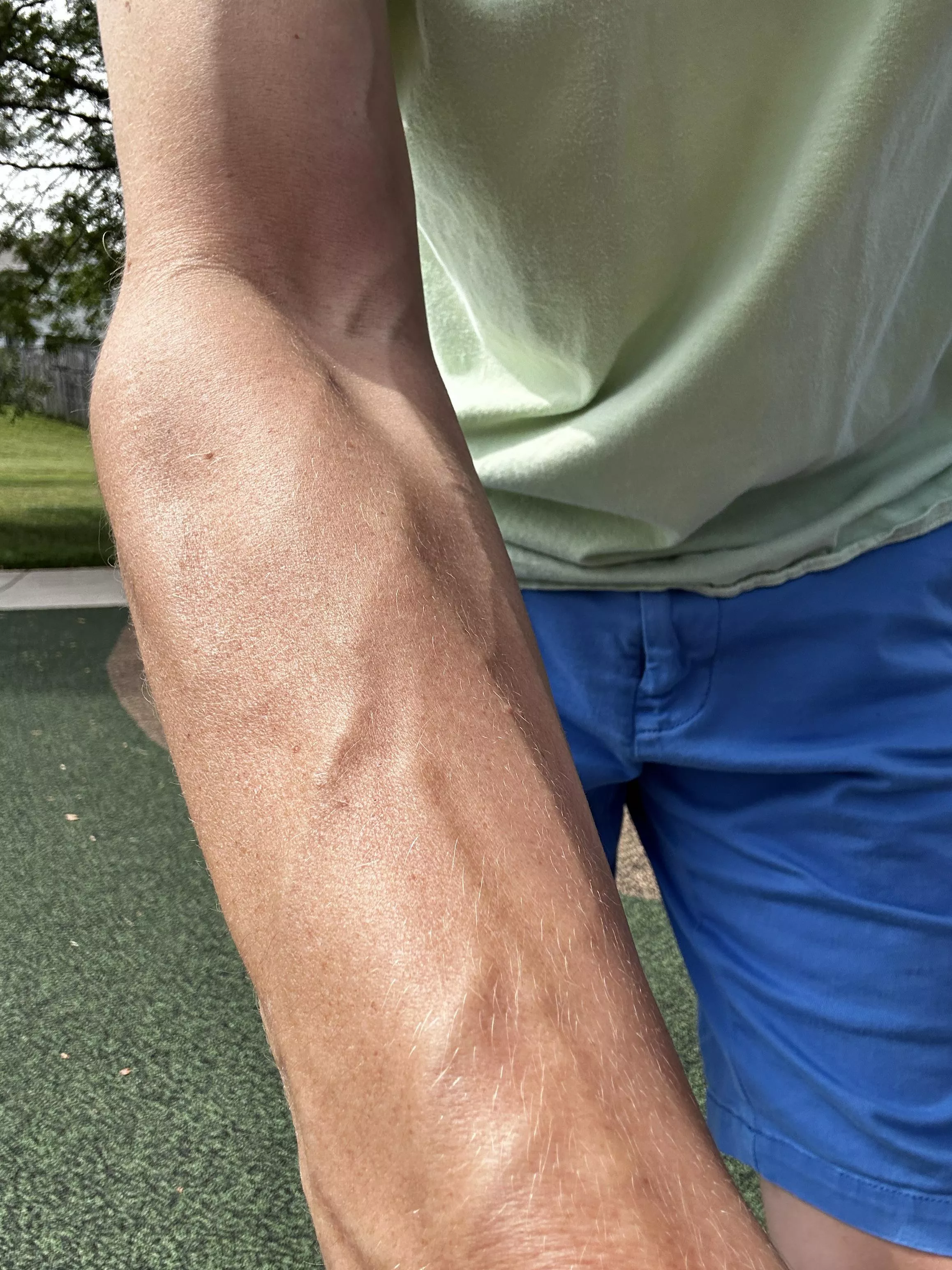 Accidental forearm selfie