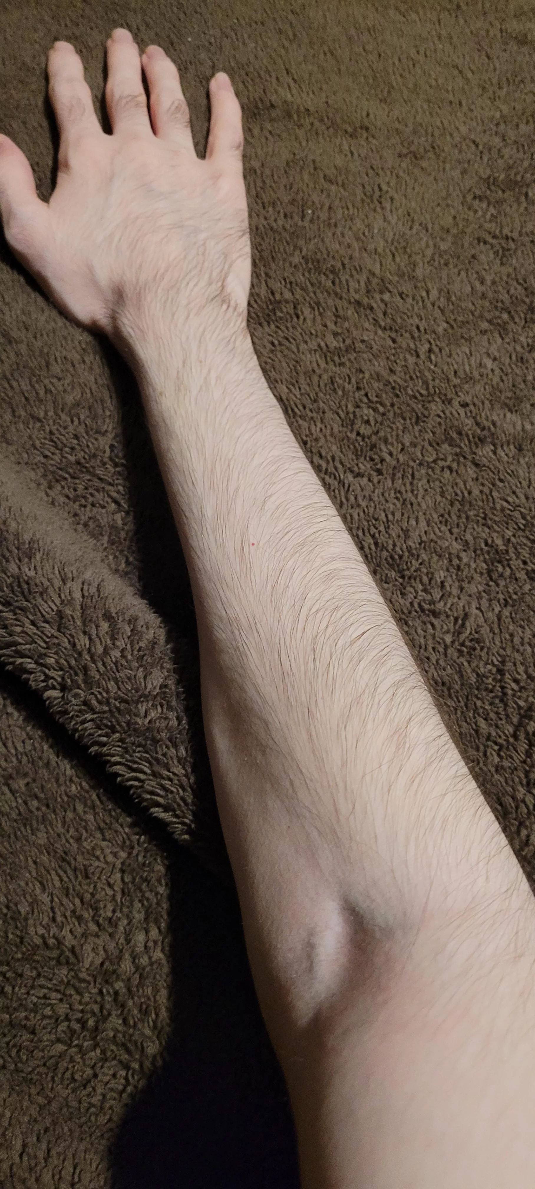 Muscles are optionnal, right ?