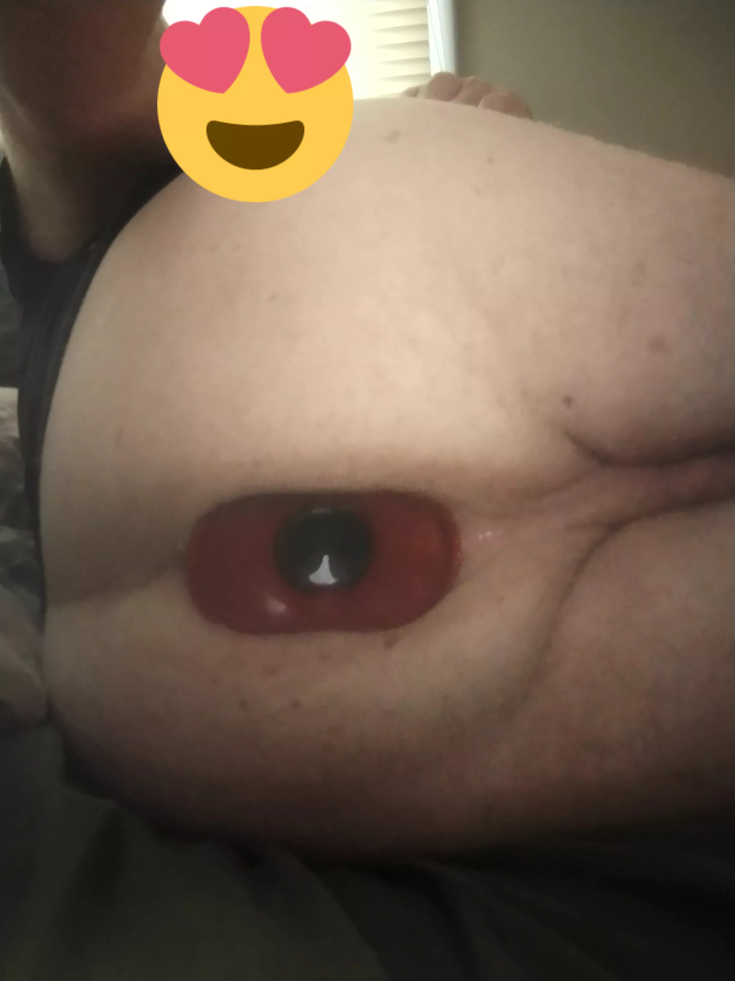 My hole won't be the same for much longer