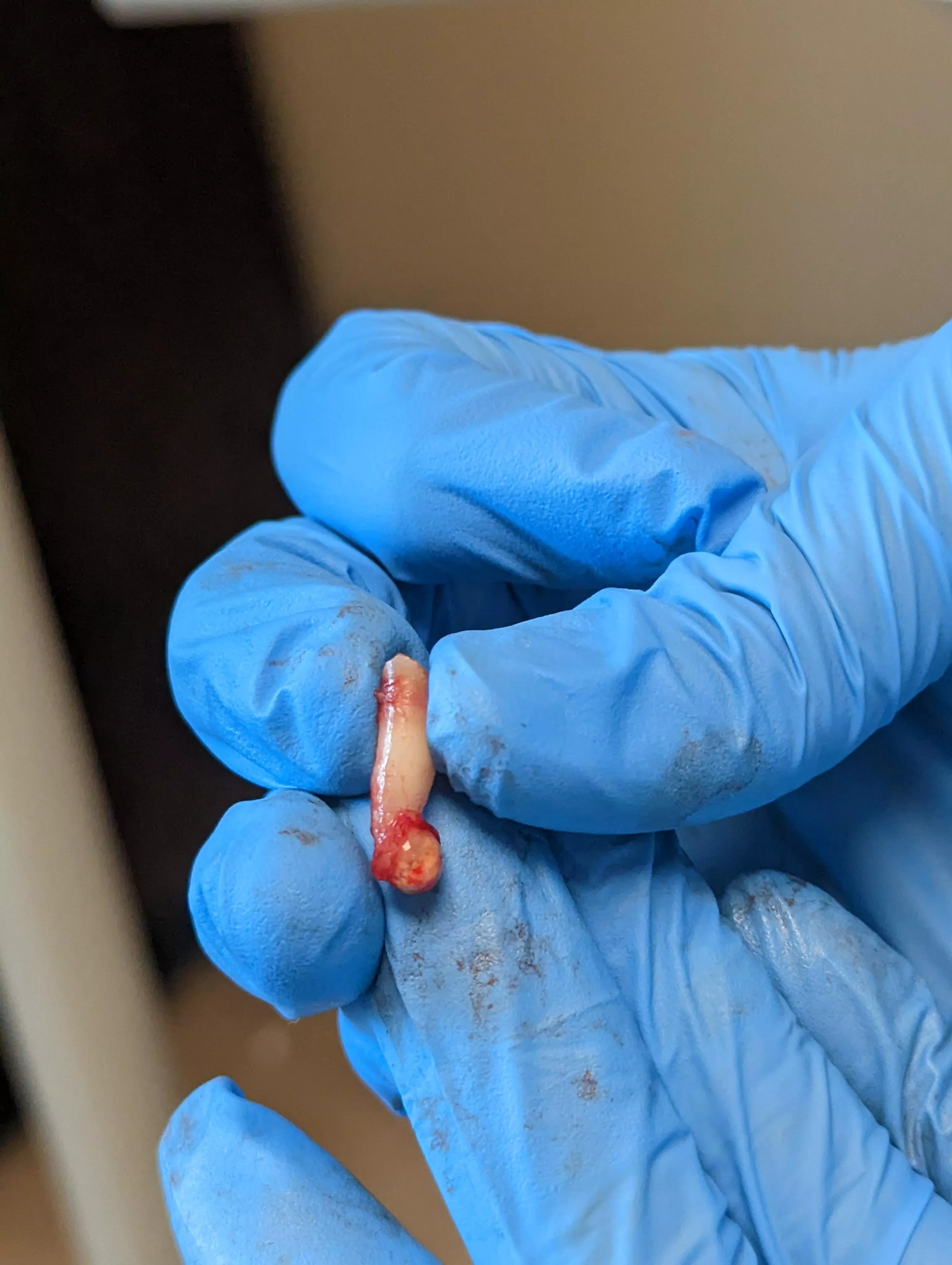 Since we are posting teeth y'all might like this.