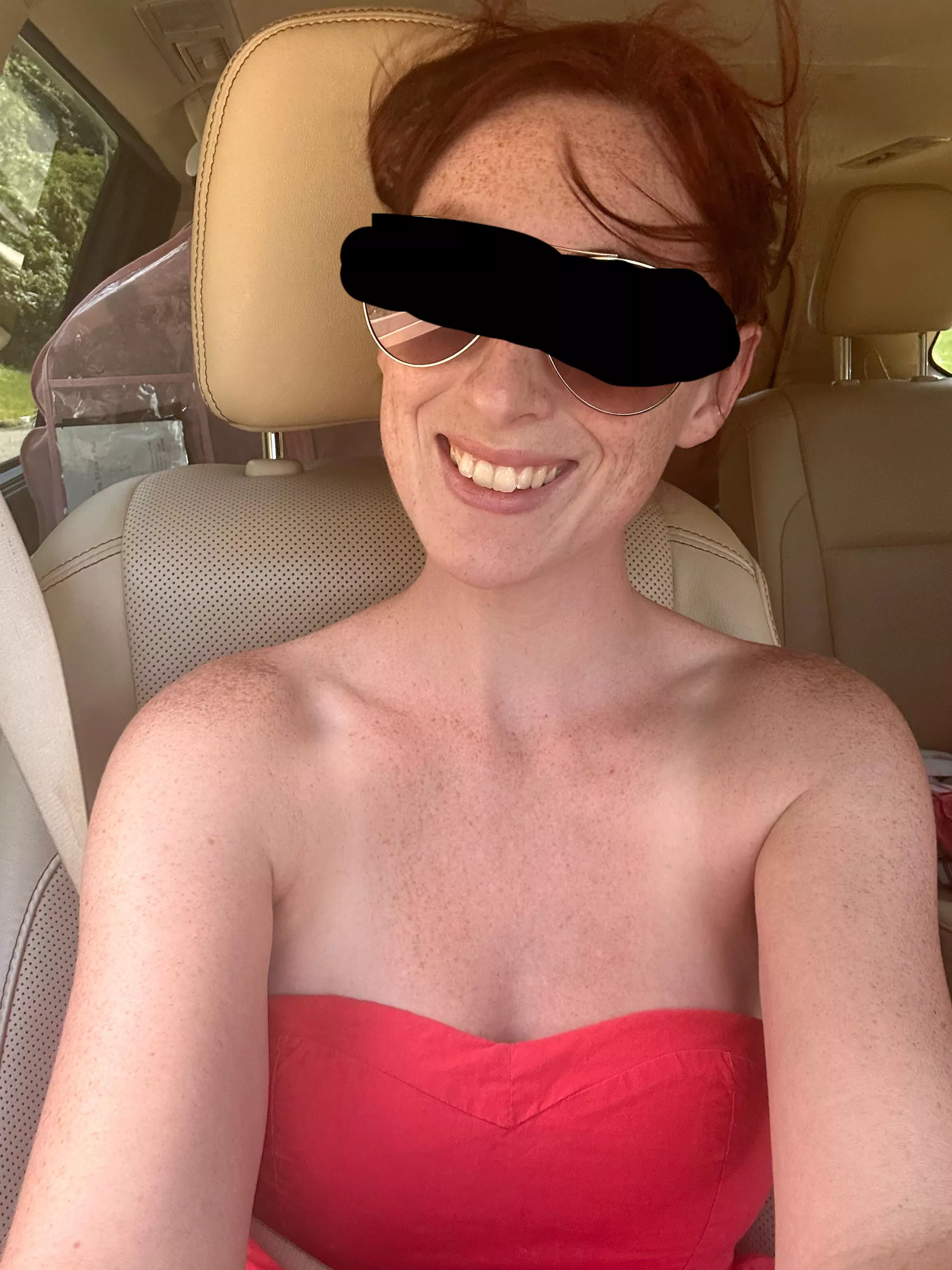 Yea I do have freckles everywhere