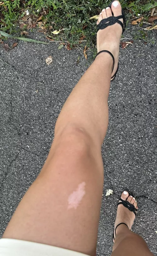 Describee my feet with one word F19