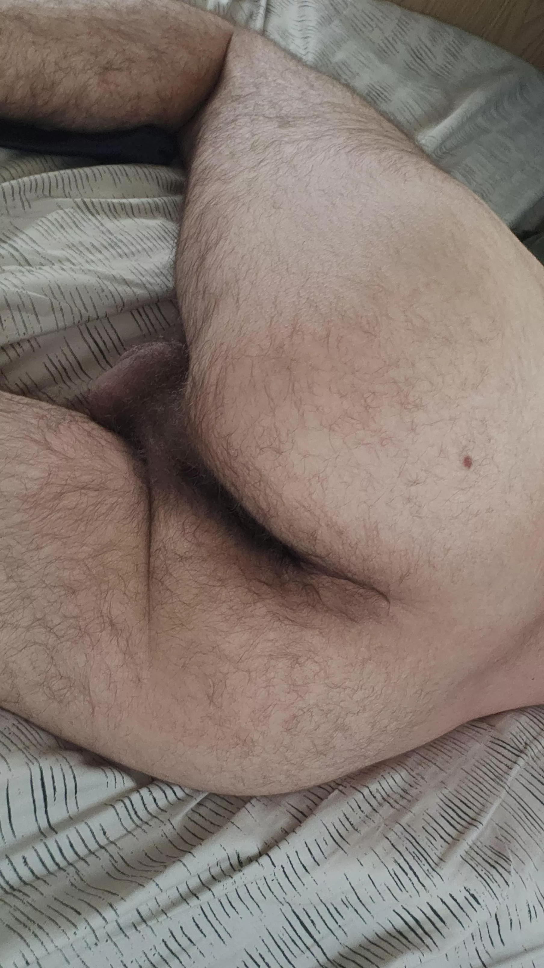 Am I too hairy?