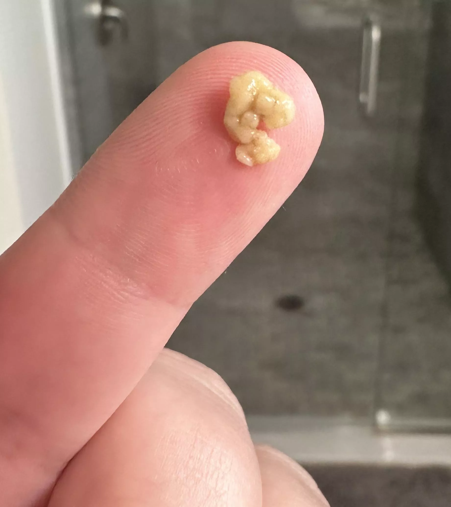 (OC) Big ole tonsil stone