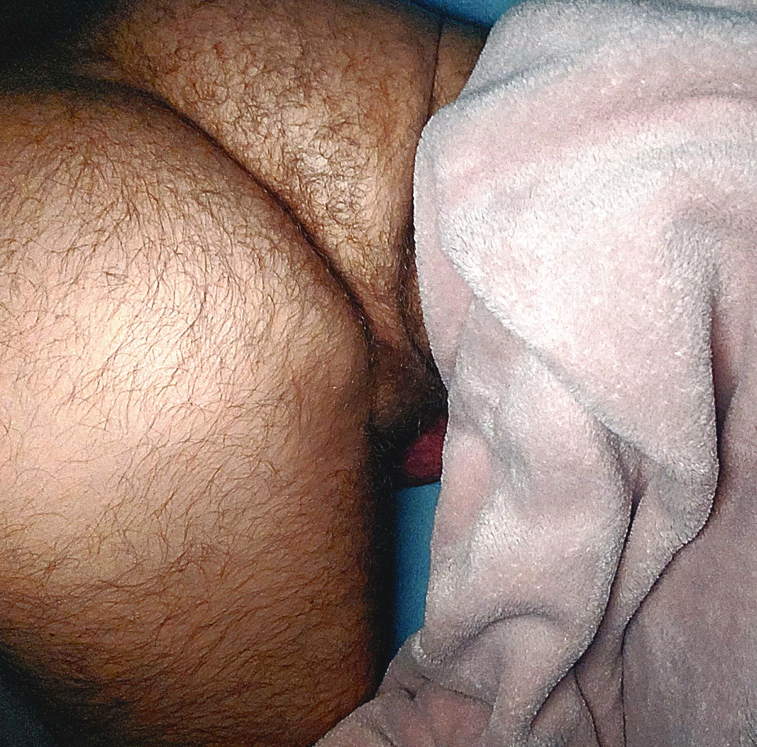 My hairy butt #2