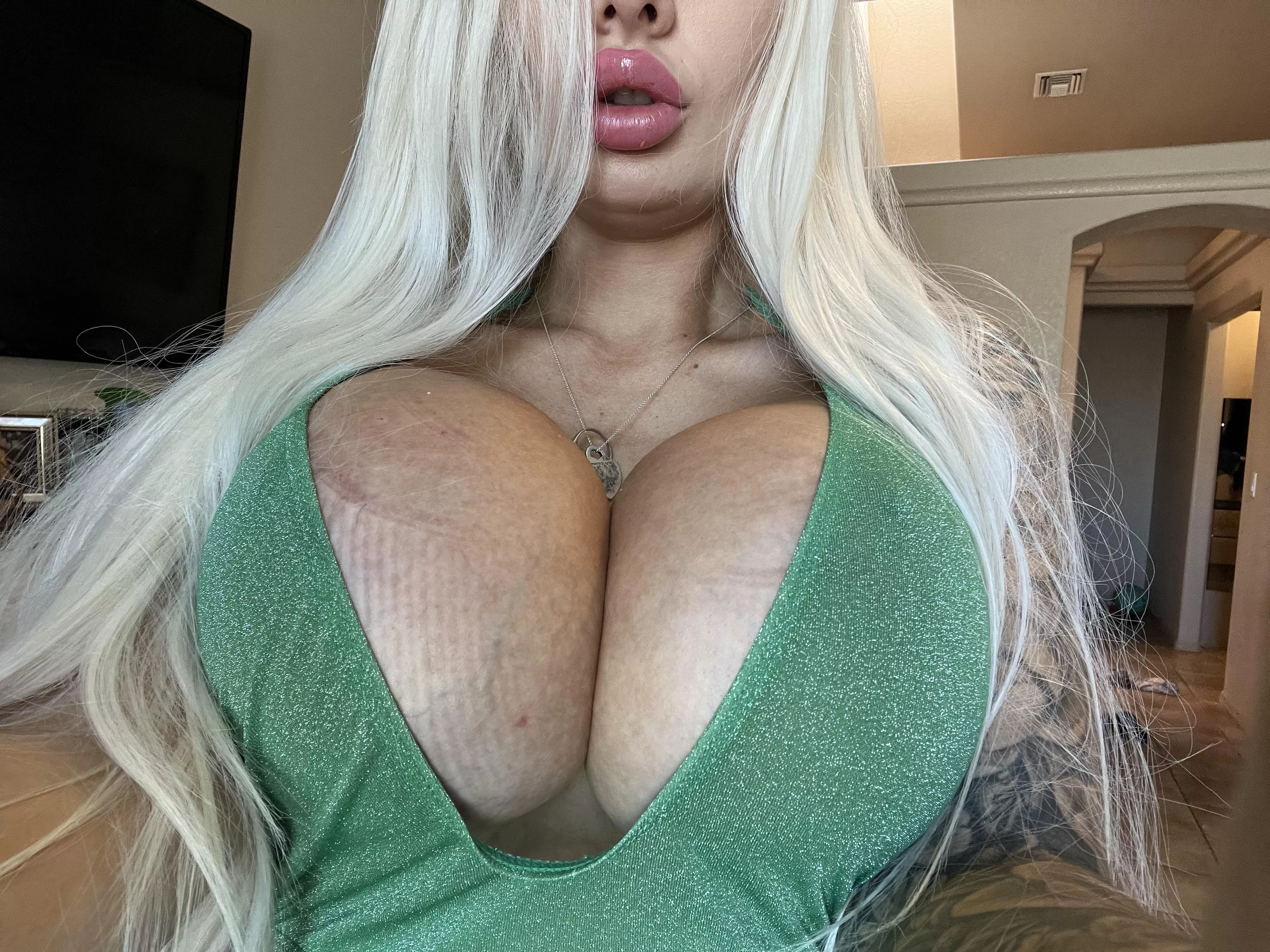 My 1400cc implants are getting bigger daily now that im pregnant