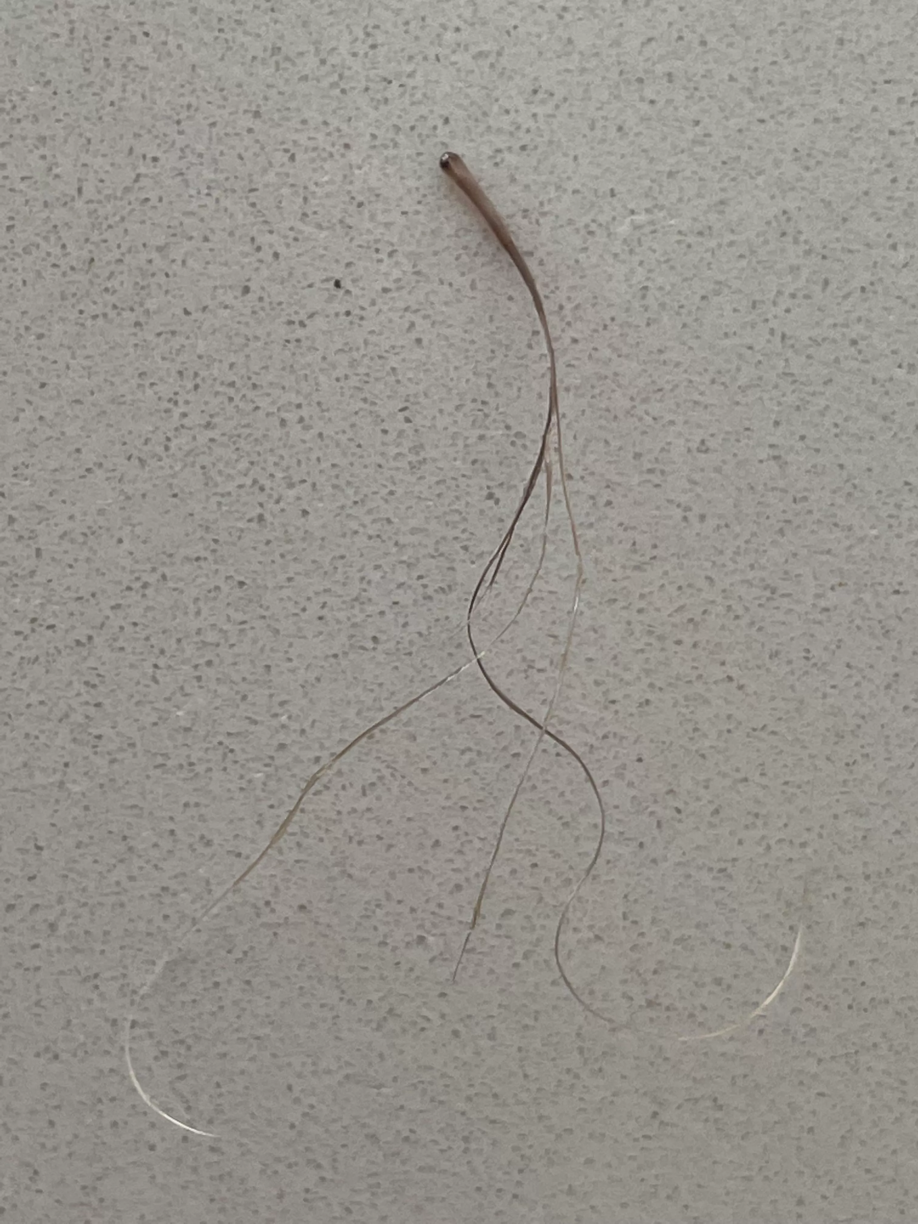 Another extracted Pili Multigemini from my beard, this one was super itchy