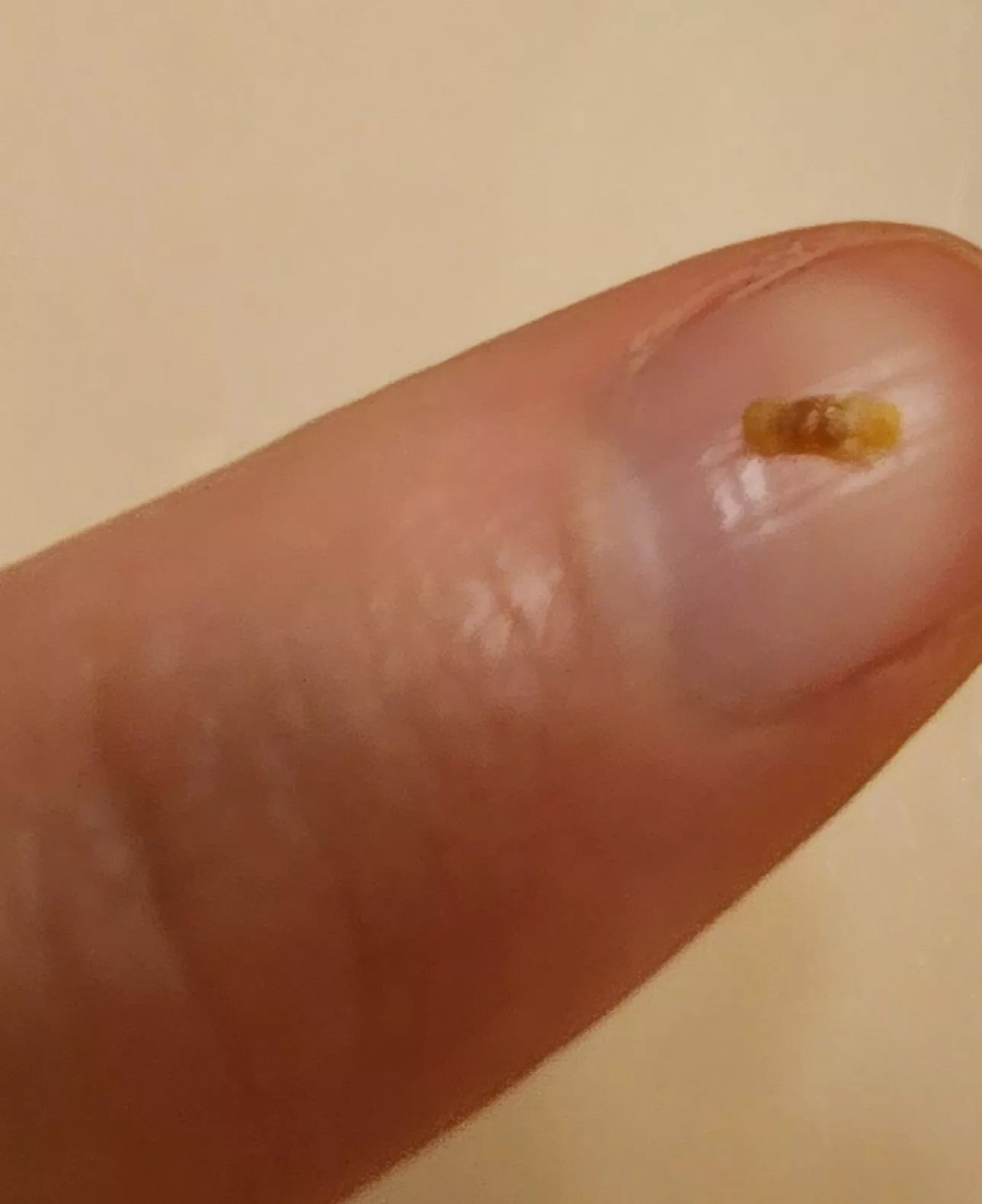 Had my belly button pierced for years. Took the piercing out a couple years ago and just got this out of the hole