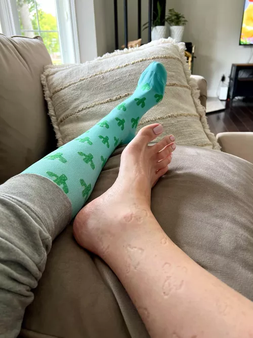 My socks are leaving cactus prints on my legs 🙊 [selling]