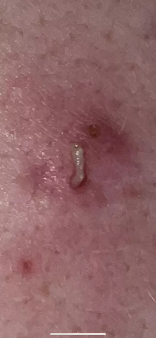Nice pop on my bfs back
