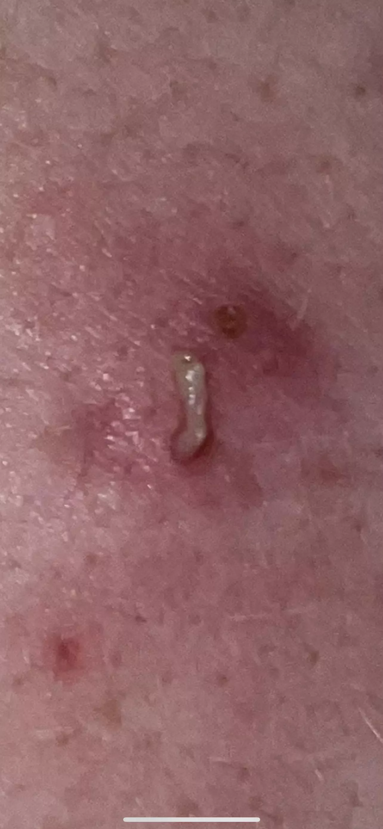 Nice pop on my bfs back
