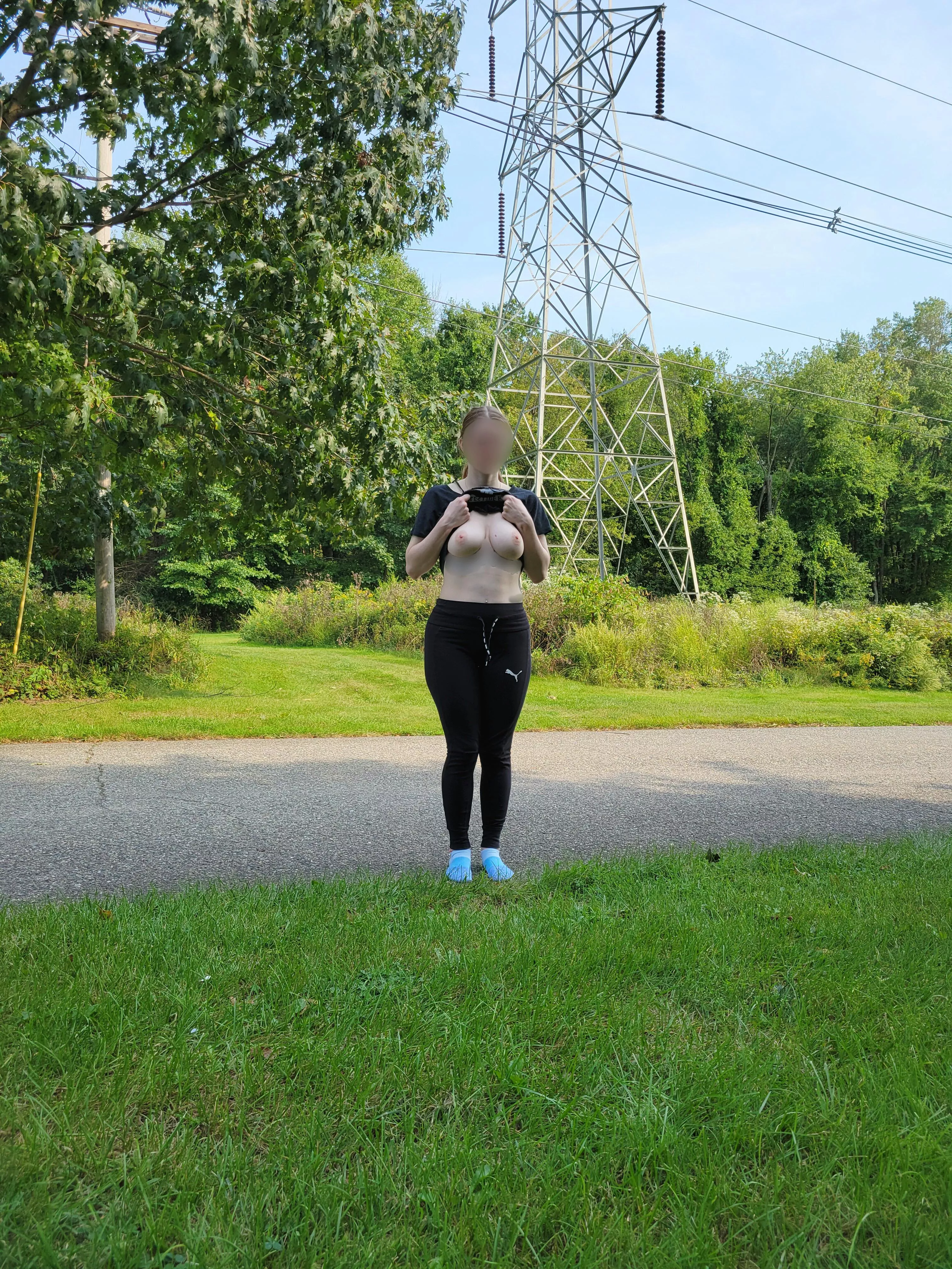 Sun kissed skin at the park