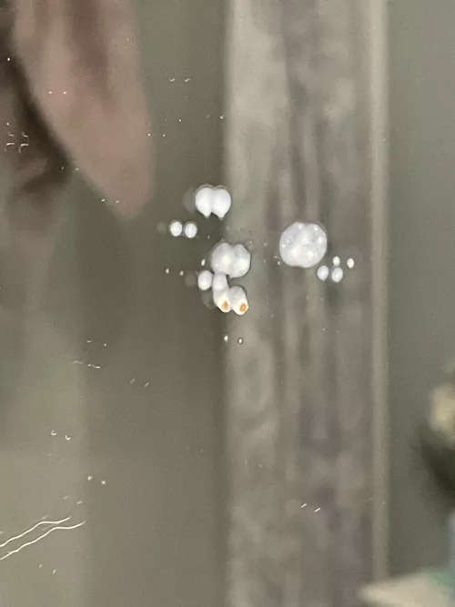 Tried to dig for tonsil stones but this sprayed out of the back of my throat instead