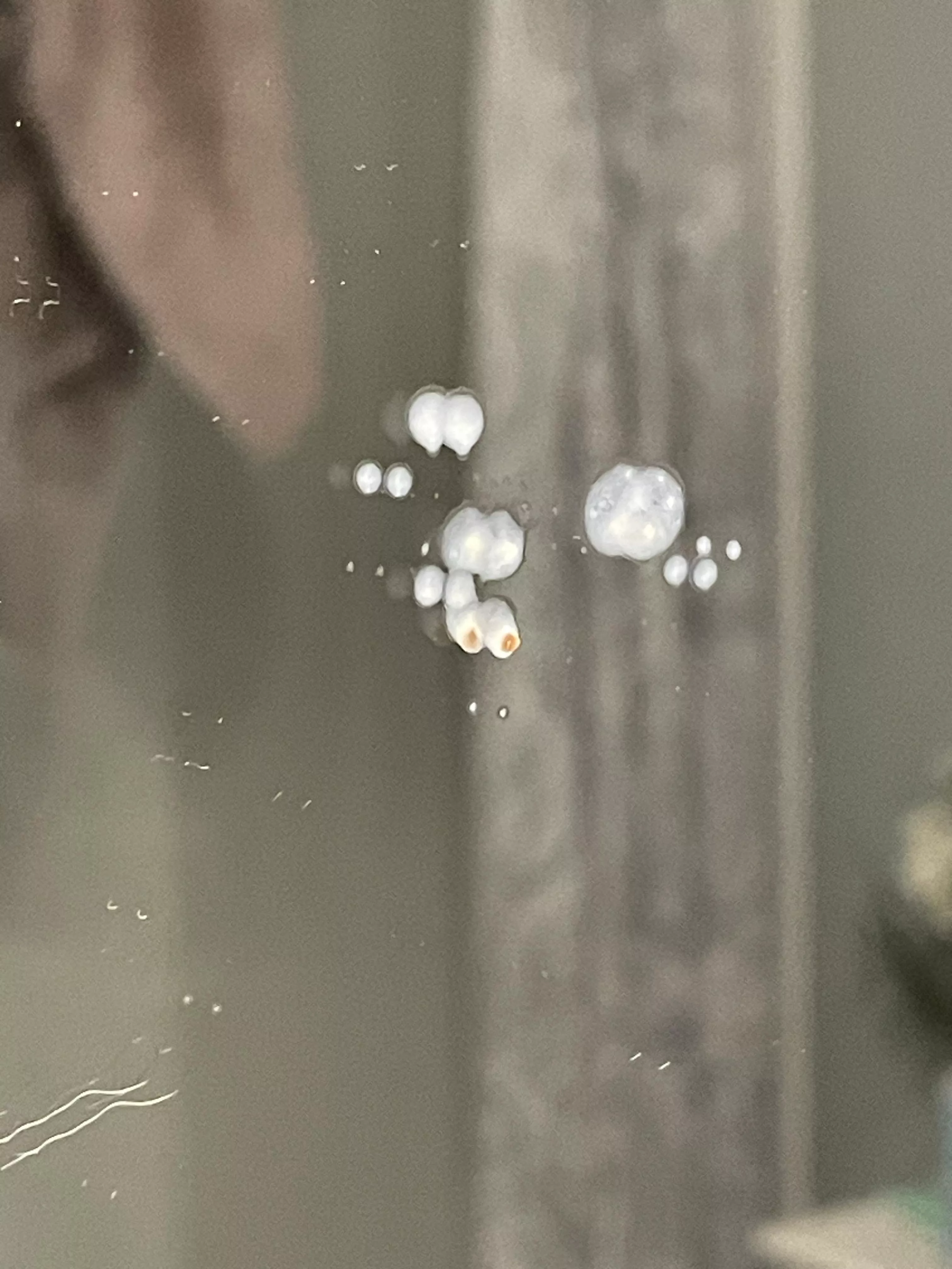 Tried to dig for tonsil stones but this sprayed out of the back of my throat instead