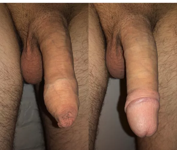 Left or right?