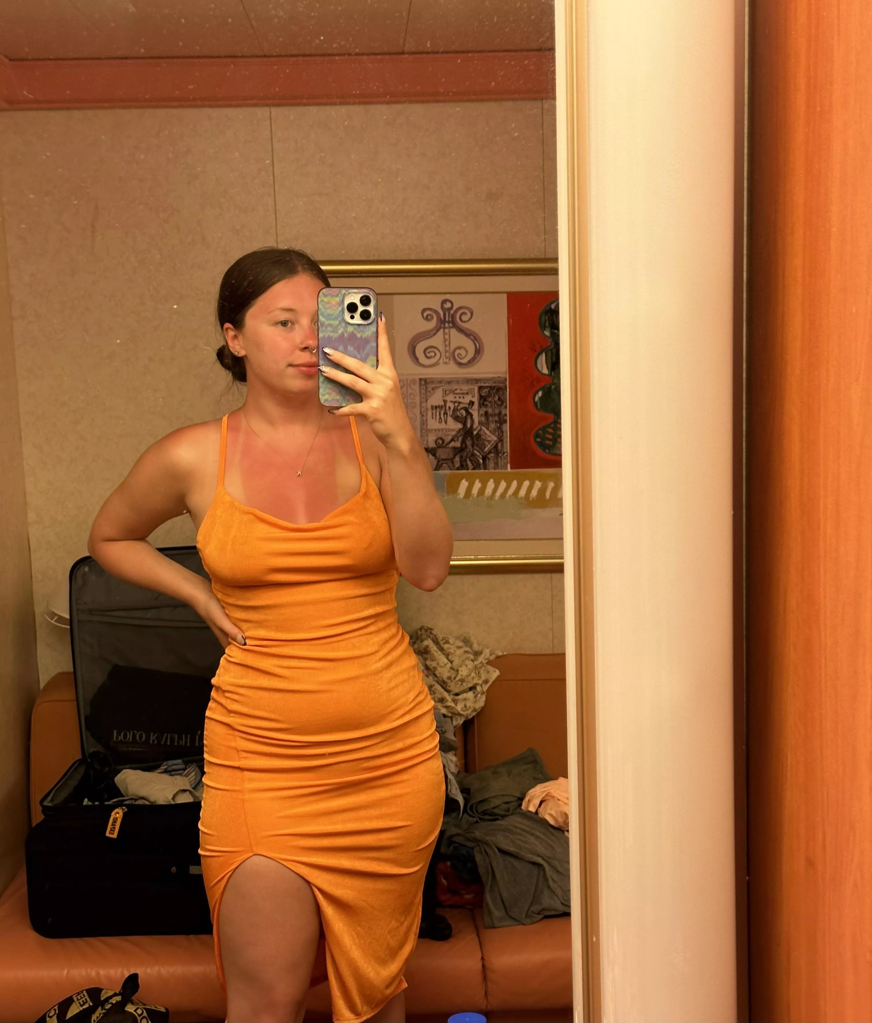 little burnt from the sun >.<