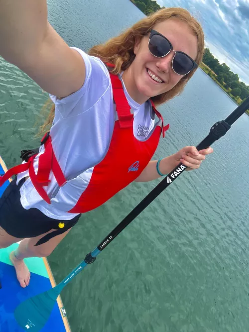 I don’t tan, I freckle