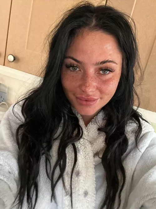 Are freckles cute IUTR