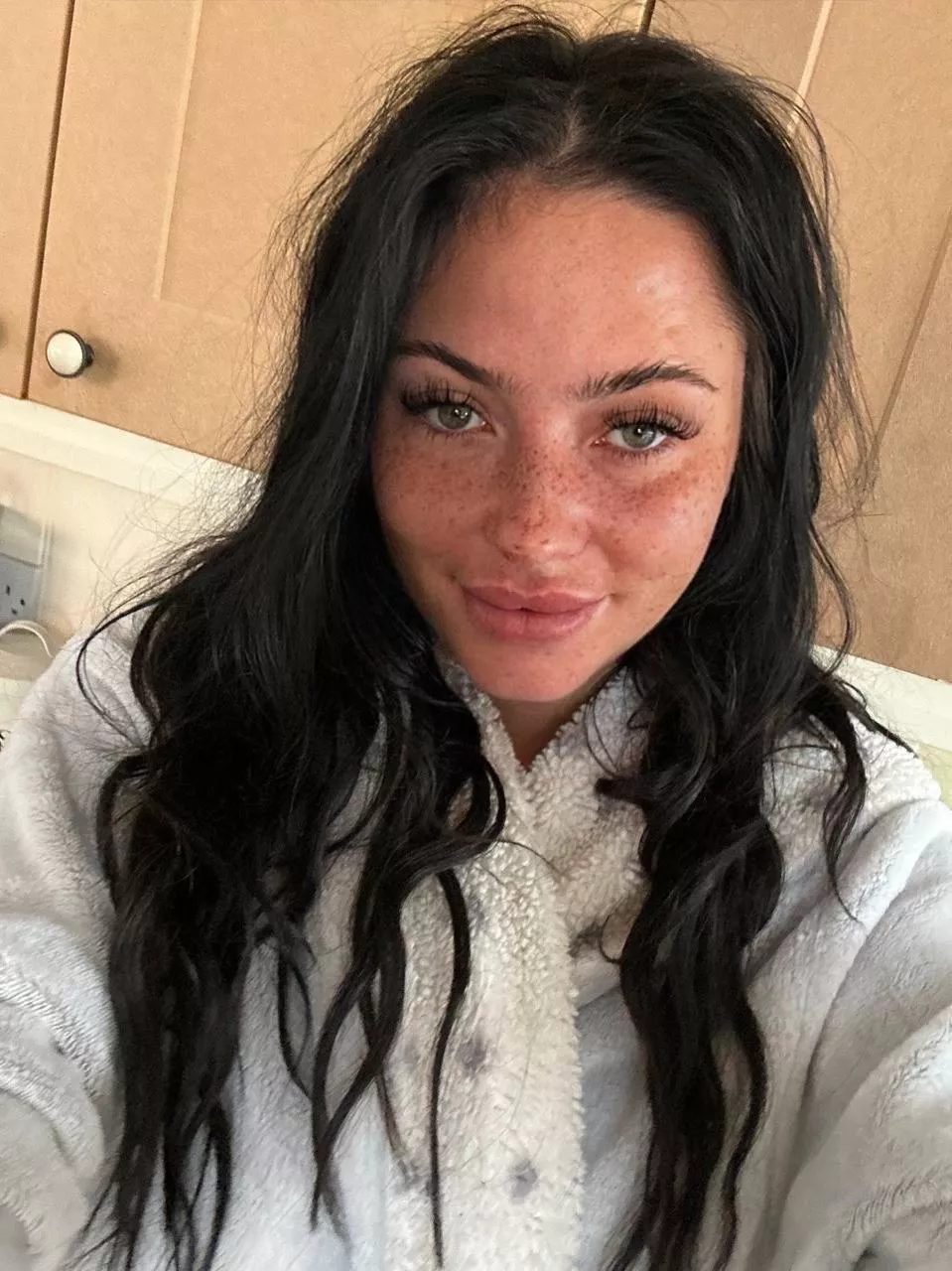 Are freckles cute IUTR