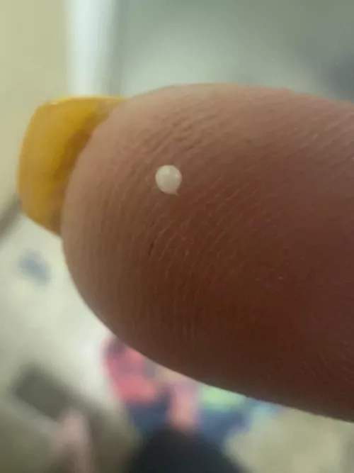 What even is this???