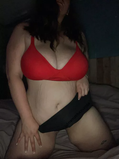 Do stretch marks bother you?